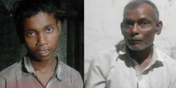 कुत्ते के काटने के बाद बच्चा करने लगा ‘भौंकने’ जैसी हरकत, जांच में निकली चौंकाने वाली बीमारी